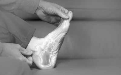 Cómo preparase antes de una intervención en el pie – Guía para pacientes